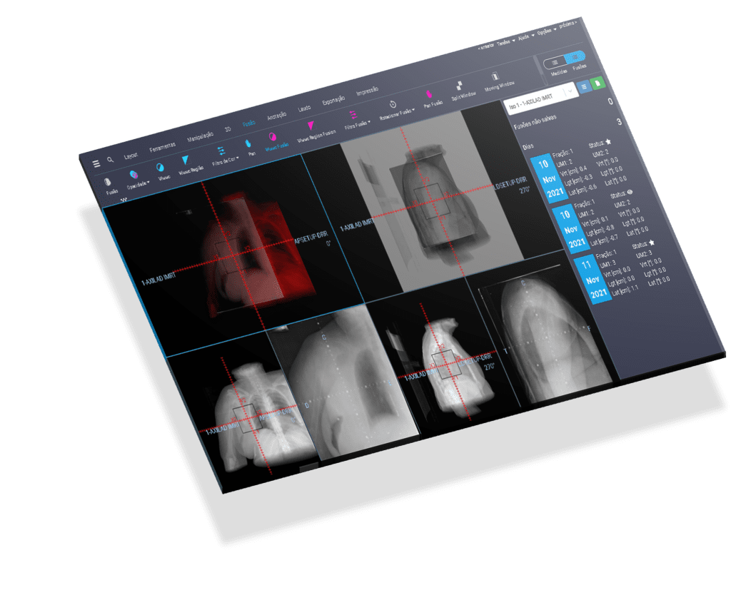 screenshot of RT PACS